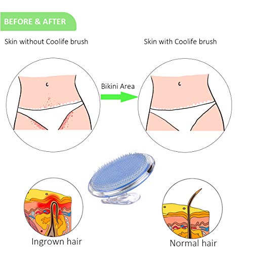 Coolife Ingrown Hair Remover Razor Bumps Keratosis Pilaris Kp