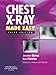 Chest X-Ray Made Easy