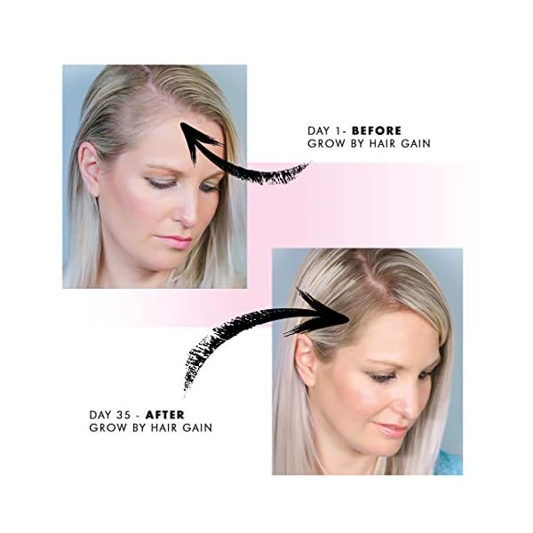 Grow-by-Hair-Gain-1-Month-supply-60-Capsules-Fuller-Thicker-Hair-in-one-month Grow by Hair Gain 1 Month supply 60 Capsules Fuller Thicker Hair in one month