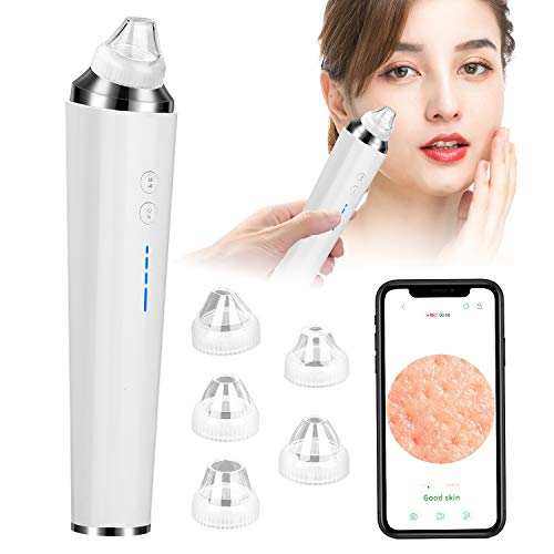 Blackhead Remover Vacuum with
