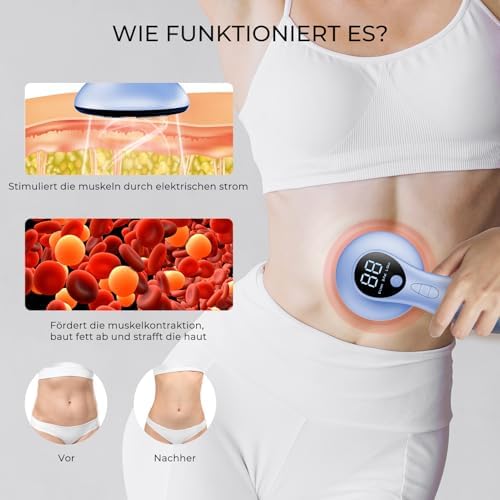 Cellulite Massagegerät mit 4 MassageköPfen, Anti Lipödem Handmassagegerät