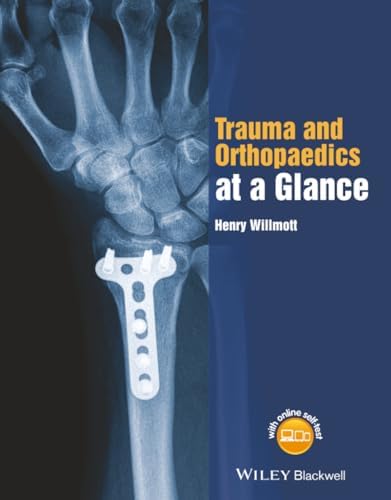 Ao Principles of Fracture Management: 9780865778863: Medicine