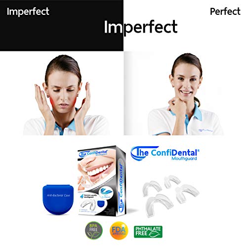 5 ConfiDental+Moldable+Clenching+Whitening+Including