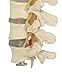 4-Part Human Lumbar Vertebrae Spine Set Anatomy Model
