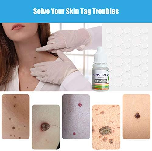 Skin Tag Remover,Skin Tag Remover Patches, Mole Remover
