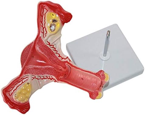 Human Female Ovary Model, Anatomical Reproductive Organs Model, for School Teach Display