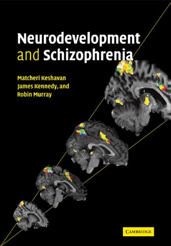 NEURODEVELOPMENT AND SCHIZOPHRENIA
