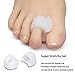 Seaside Brother Bunion Corrector & Bunion Relief Protector Sleeves Kit - Treat Pain in Hallux Valgus, Big Toe Joint, Hammer Toe, Toe Separators Spacers Straighteners Splint Aid Surgery treatment-7Pcs
