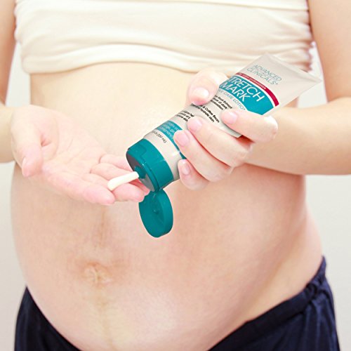 Advanced Clinicals Stretch Mark Lotion. Moisturizing Cream for Scars