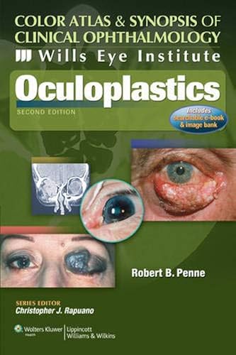 Download Color Atlas & Synopsis of Clinical Ophthalmology: Wills Eye Institute - Oculoplastics PDF