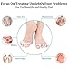 Toe Separators, Toe Spacers Toe Straightener Toe Protector Shoe Stretcher Bunion Splint, Gel Toe Separator Toe Stretchers Used for Yoga, Bunion Corrector Relaxing Toes for Women and Men Update