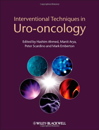 Interventional Techniques in Uro-oncology