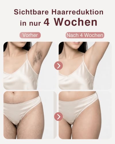 TIIMAGIC IPL Geräte Haarentfernung – 5℃ Eiskühlkontakt Schmerzfreie Haarentfernungsgerät zu Hause und Langanhaltende Ergebnisse, 86% Haarreduktion in 3 Wochen für Körper Gesicht Bikini Achseln Beine