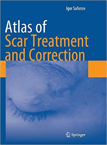 Atlas Of Scar Treatment And Correction 9783642291951 Medicine Health Science Books Amazon Com