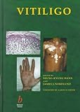 Vitiligo : A Monograph on the Basic and Clinical Science, Hann, Seung-Kyung, 0632050713