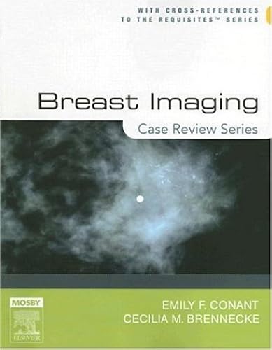 Download Breast Imaging: Case Review Series PDF