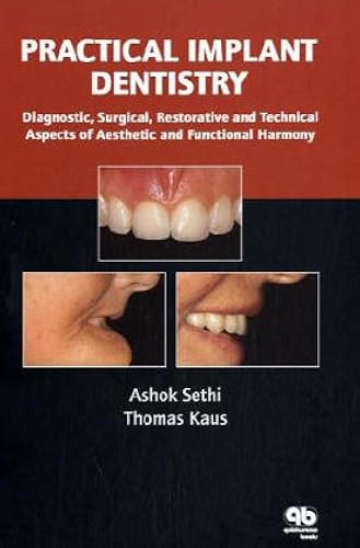 Download Practical Implant Dentistry: Diagnostic, Surgical, Restorative And Technical Aspects Of Aesthetic And Functional Harmony PDF