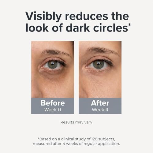 Under Eye Brightener Roller - Caffeine & Retinol Eye Serum for Dark Circles, Puffiness & Fine Lines, Travel Essential Vegan Skincare, Cooling Eye Massage, Dermatologist-Tested, 0.52 fl oz