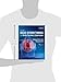 Huszar's Basic Dysrhythmias and Acute Coronary Syndromes: Interpretation and Management Text & Pocket Guide Package