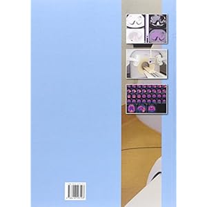 TÚcnicas de imagen por medicina nuclear