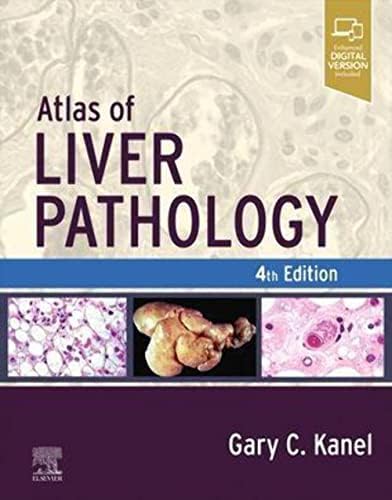 MacSween's Pathology of the Liver: 9780702082283: Medicine