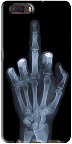 Enlinea Printed ZTE Nubia M2 Designer Back Cover | ZTE Nubia M2 Printed Back Cover | Printed Soft Silicone Back Cover for ZTE Nubia M2 Pattern -5