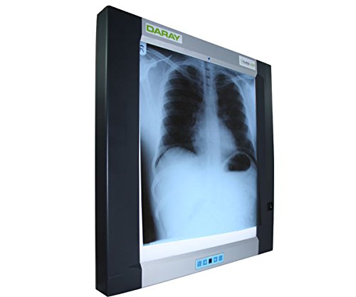 DARAY Medical DX4101LED LED Single-Panel X-Ray Film Viewer