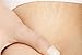 Best Stretch Mark Microdermabrasion Crystals 3lbs- Most Effective treatment for Old White Stretch Marks pure Stretch Mark Microdermabrasion Medical Crystals for manual use 3lbs shown to remove dead skin cells, exfoliate rough skin,repair scars and old white stretch marks, fade sunspots from sun damage,leaves skin glowing, smooth and younger looking