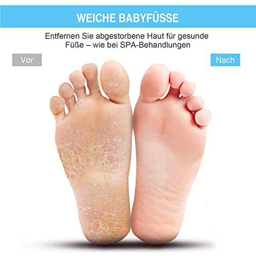 HONYIN Large Foot Brush Foot Washer Bath Massage Pad with Non-Slip Suction Cups - Cleans, Exfoliates, Massages Your Feet Without Bending, Foot Circulation & Relieves Tired Feet (28 x 28 cm)