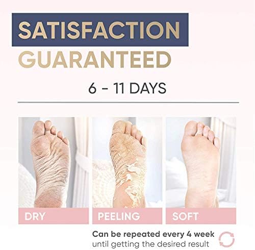 foot peel for men