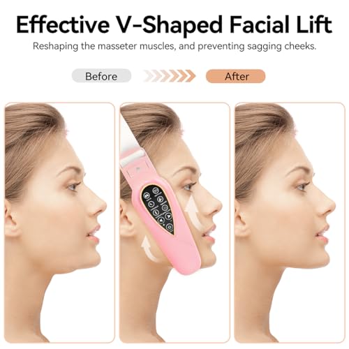 Masajeador eléctrico V-Face Shaping + electroestimulador versión 2026 | Eliminador y tonificador de papada | Masajeador facial EMS, fototerapia roja y azul, 5 modos de terapia + mando a distancia