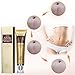 Amareu Acne Scar Removal Cream Skin Repair Face Cream For Burns Cuts Operation Stretch Mark Remover Acne Scars Treatment