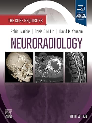 Amazon.com: Osborn's Brain E-Book eBook : Osborn MD, FACR, Anne G