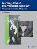 Teaching Atlas of Interventional Radiology : Non-Vascular Interventional Procedures, , 1588900568