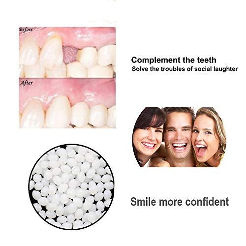 Temporary Teeth Repair Kits Moldable Thermal Fitting Beads for