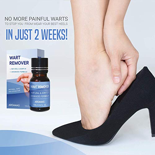 Aroamas All-Natural Wart Remover Treatment, Maximum Strength for Common Warts and Infections, Also Promotes The Healing of Calluses and Corns