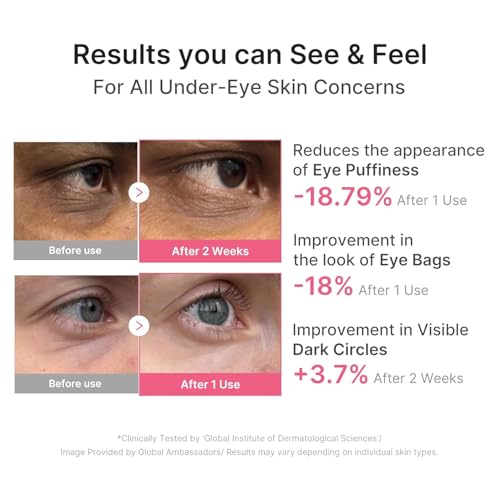 PDRN Caffeine Collagen Eye Patch | Gel Eye Patches for the appearance of Dark Circles, Undereye Bags | Firming, Age-Defying Care with Retinol, Collagen | Korean Skincare | 30 Pairs