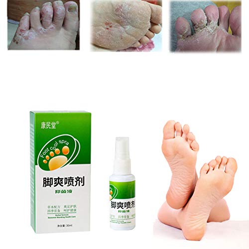 Foot Deodorant Spray, Zhengpin Herbal Formula Anti Fungal Remover, Foot Odor Sweat Eliminator Antibacterial Plant Bacteriostatic Herb Spray Foot Care (A)