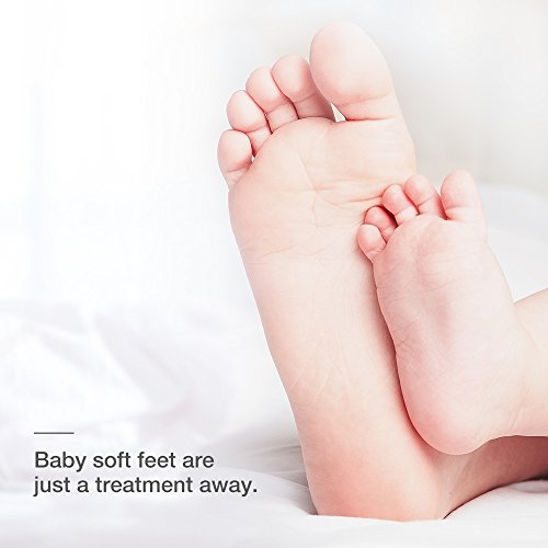 Foot Peel Mask, Antifungal Exfoliating Foot Mask for Dry and Dead Skin, Rebirth of Baby Soft Foot in a Week, Must-have Foot Callus Remover, Lavender Scented, 1 Pair