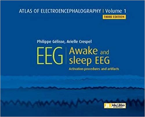 Atlas Of Electroencephalography Awake And Sleep Eeg Activation Procedures And Artifacts John Libbey Philippe Gelisse Arielle Crespel 9782742015900 Amazon Com Books