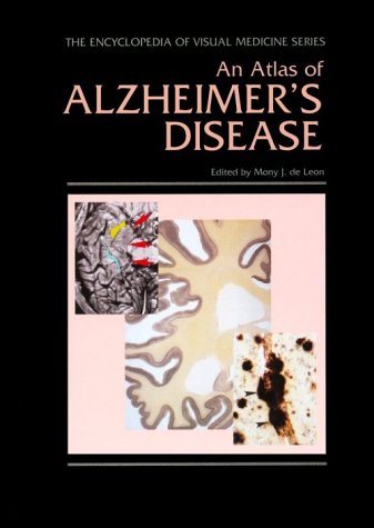 An Atlas of Alzheimer's Disease
