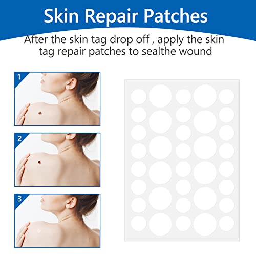 2 Size Automatic Removal Pen Set, Effective, Painless, Easy And Safe For Small To Large Size Warts And Moles (1-9 MM)