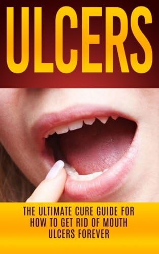 Ulcers: The Ultimate Cure Guide for How to Get Rid of Mouth Ulcers Instantly (Ulcer Free, Ulcer Diet, Mouth Ulcer Cure, Oral Ulcer)