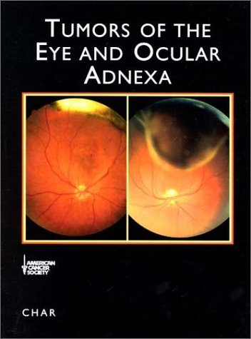 TUMORS OF THE EYE AND OCULAR ADNEXA