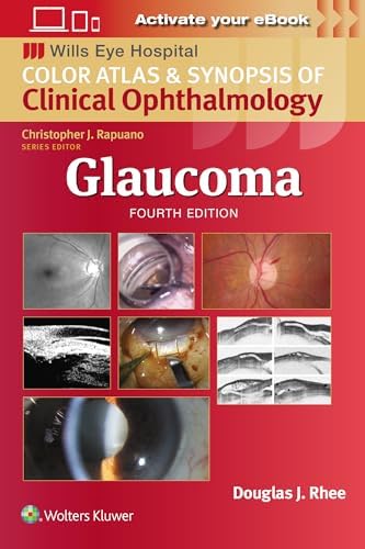 Glaucoma: 2-Volume Set: 9780702051937: Medicine & Health Science