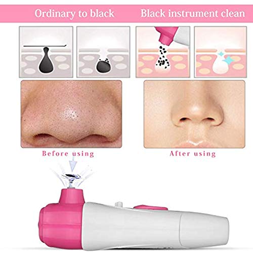 Electric Facial Pores Cleanser Blackhead Acne Removal Acne Pimple Spot Remover
