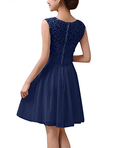 ZANZEA-Damen-Spitze-rmellos-Party-Club-Kurz-Slim-Abend-Brautkleid-Cocktail-Ballkleid