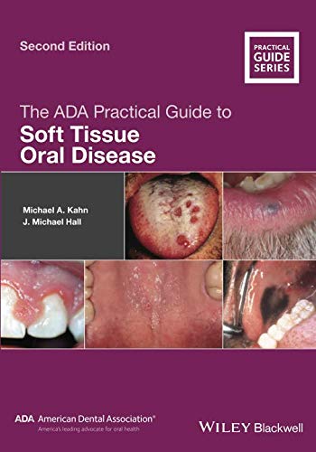 BEST! The ADA Practical Guide to Soft Tissue Oral Disease, 2nd Edition [P.D.F]