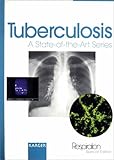 Tuberculosis : A State-of-the-Art Series, , 3805570007