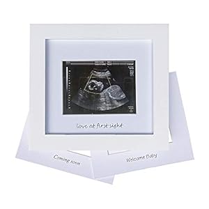 IHEIPYE Baby Sonogram Photo Frame – 1st Ultrasound Picture Frame – Idea Gift for Expecting Parents,Baby Shower, Gender…